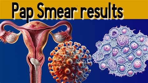 Understanding Pap Smear Results – What They .
